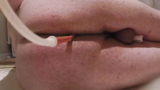 Retention Clyster and Let Go