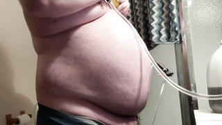 Stomach Inflation with Nearly two Gallons of Water